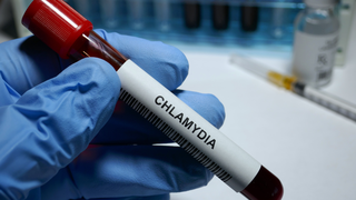 Chlamydia In Pregnancy: What Every Expecting Mother Should Know