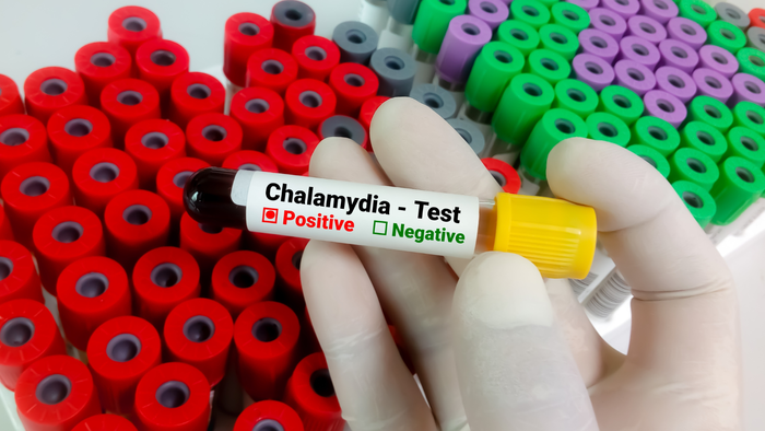 chlamydia testing during pregnancy2
