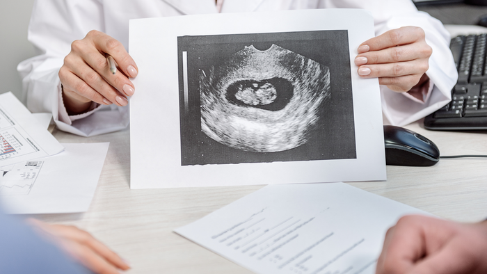 abnormal brain development during pregnancy2