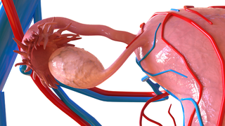 Ovarian Vein Thrombosis: Causes, Treatment and Fertility