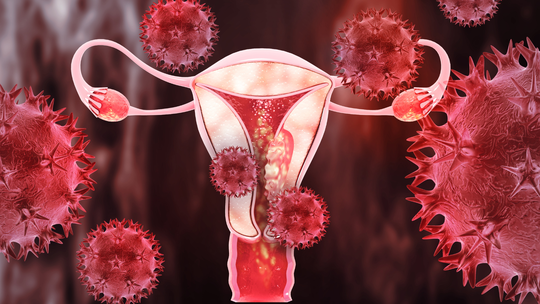 Decidual Cast: The Rare "Uterine Lining Shed Whole" Phenomenon