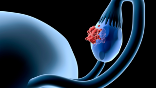 Rete Ovarii: Has Science Discovered a New Female Organ?