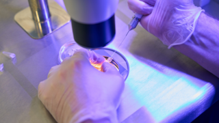 Sperm Retrieval from the Testicles: When Is It Needed for Fertility Treatment?