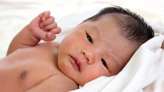 severe jaundice in newborns2