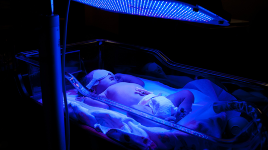 G6PD Deficiency in Newborns: Symptoms, Testing, and Care