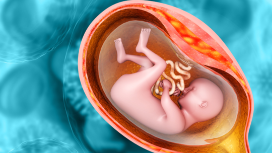 En Caul Birth: What Does It Mean When a Baby Is Born in the Amniotic Sac?