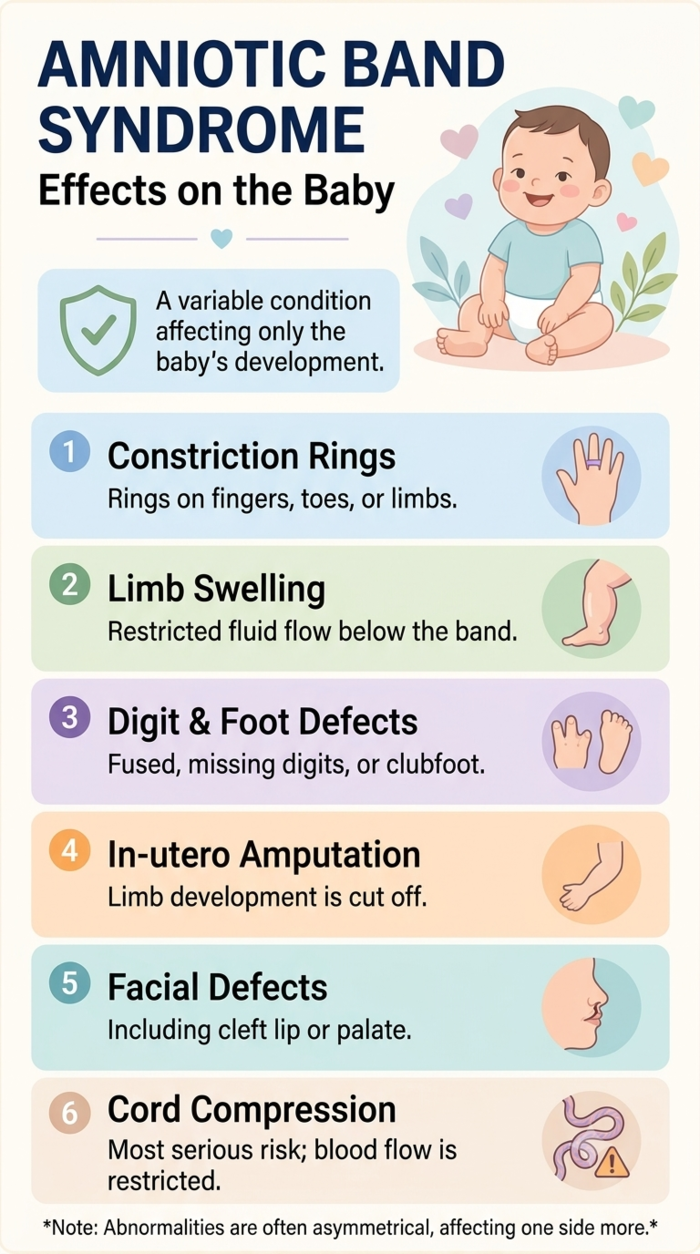amniotic band