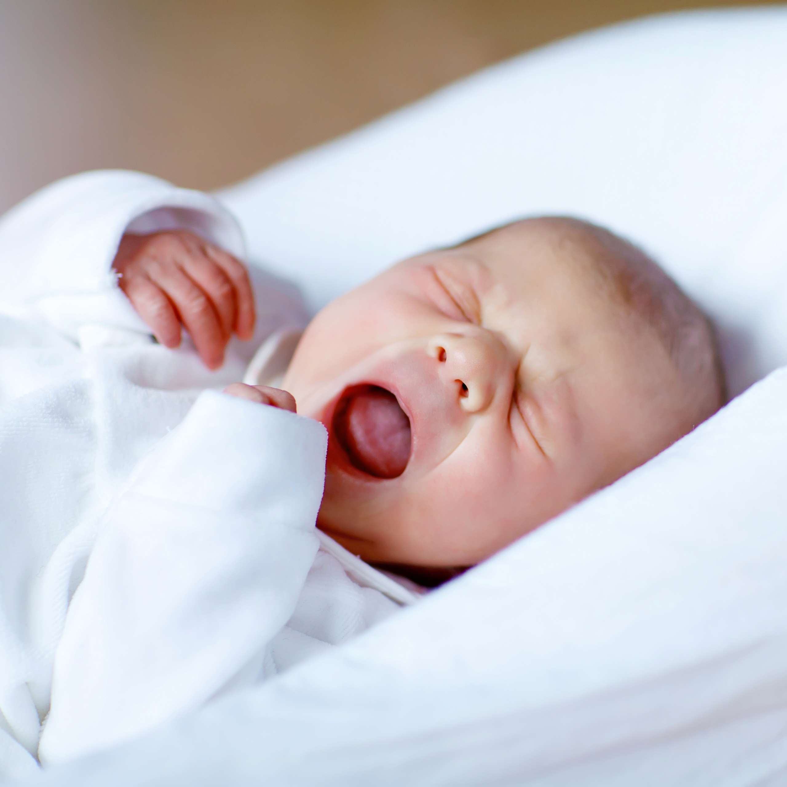 Newborn baby yawning- Fetal Meconium Aspiration