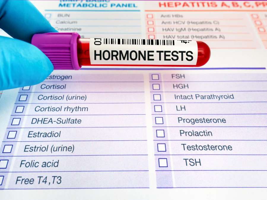 Hormone tests-Hypothyroidism And Fertility 