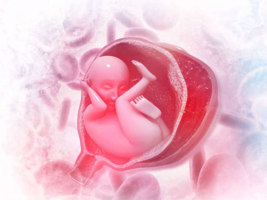 fetus- Umbilical Cord Complications