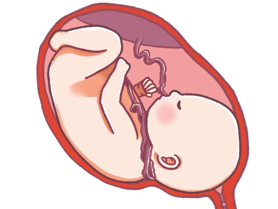 fetus with amniotic fluid- Understanding Polyhydramnios
