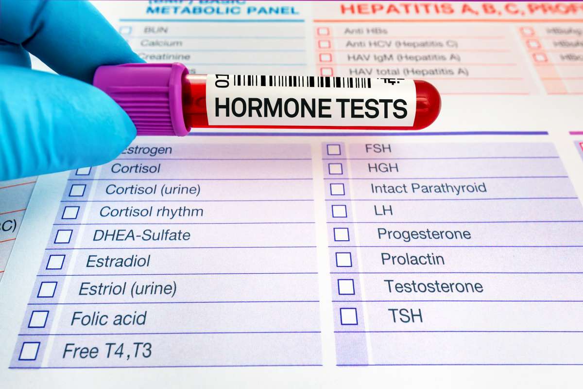 hormone tests