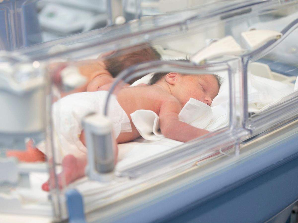 twins preterm birth- Twin-To-Twin Transfusion Syndrome