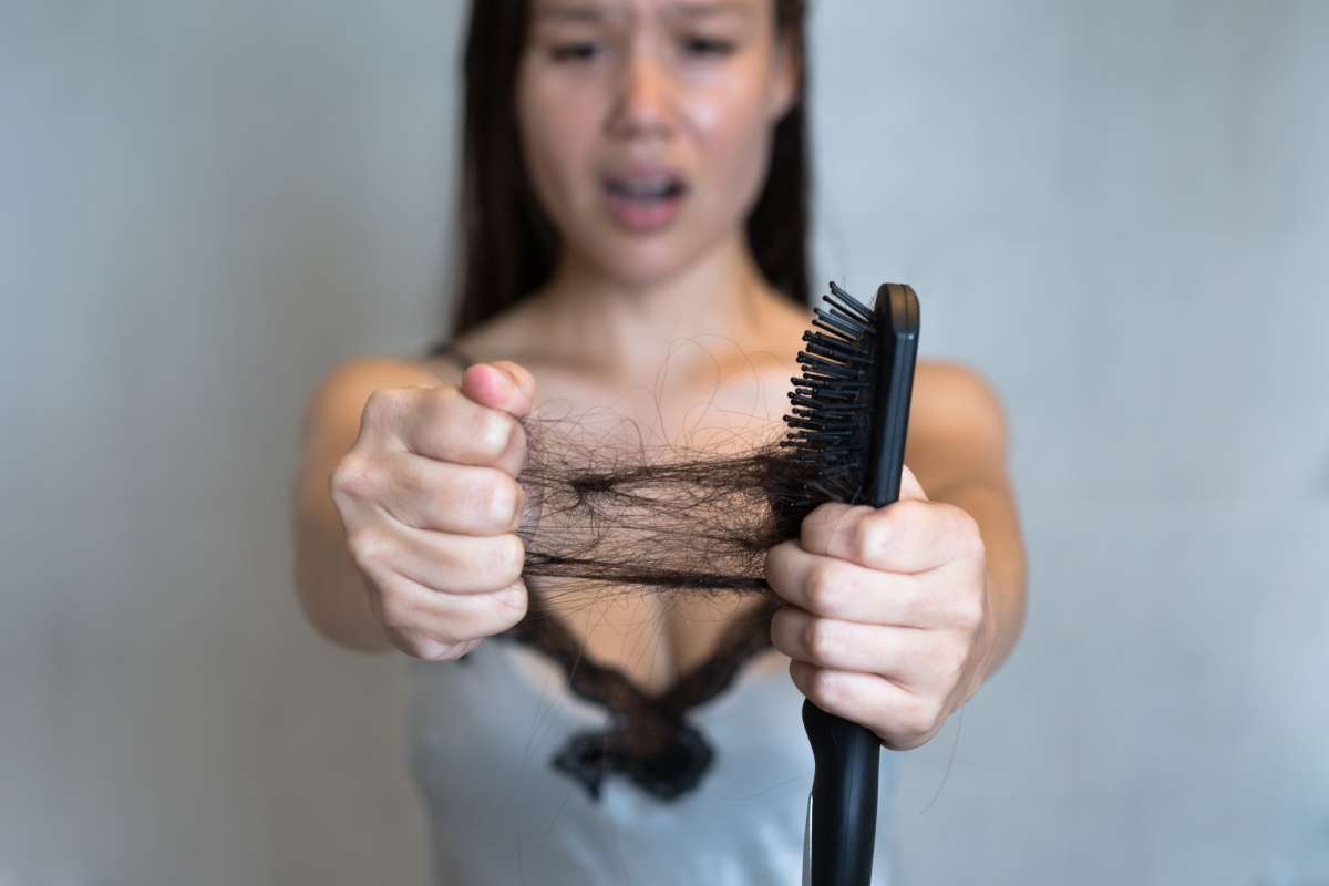 A woman's hair falling out. Hair loss- PCOD, PCOS, And Hair Loss