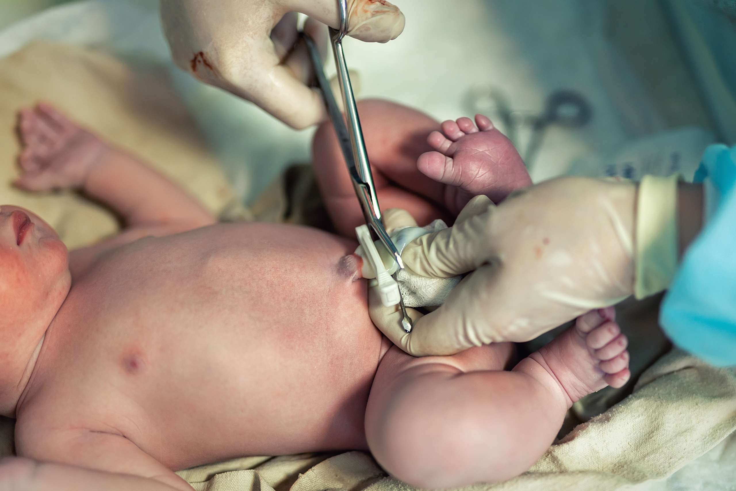 Close-up doctor obstetrician nurse cutting umbilical cord with medical scissors to newborn infant baby.