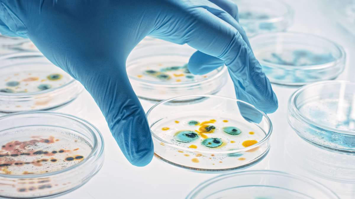 Scientist Works with Petri Dishes with Various Bacteria, Tissue and Blood Samples. Concept of Pharmaceutical Research for Antibiotics, Curing Disease with DNA Enhancing Drugs- Perinatal Epigenetics And Intergenerational Health