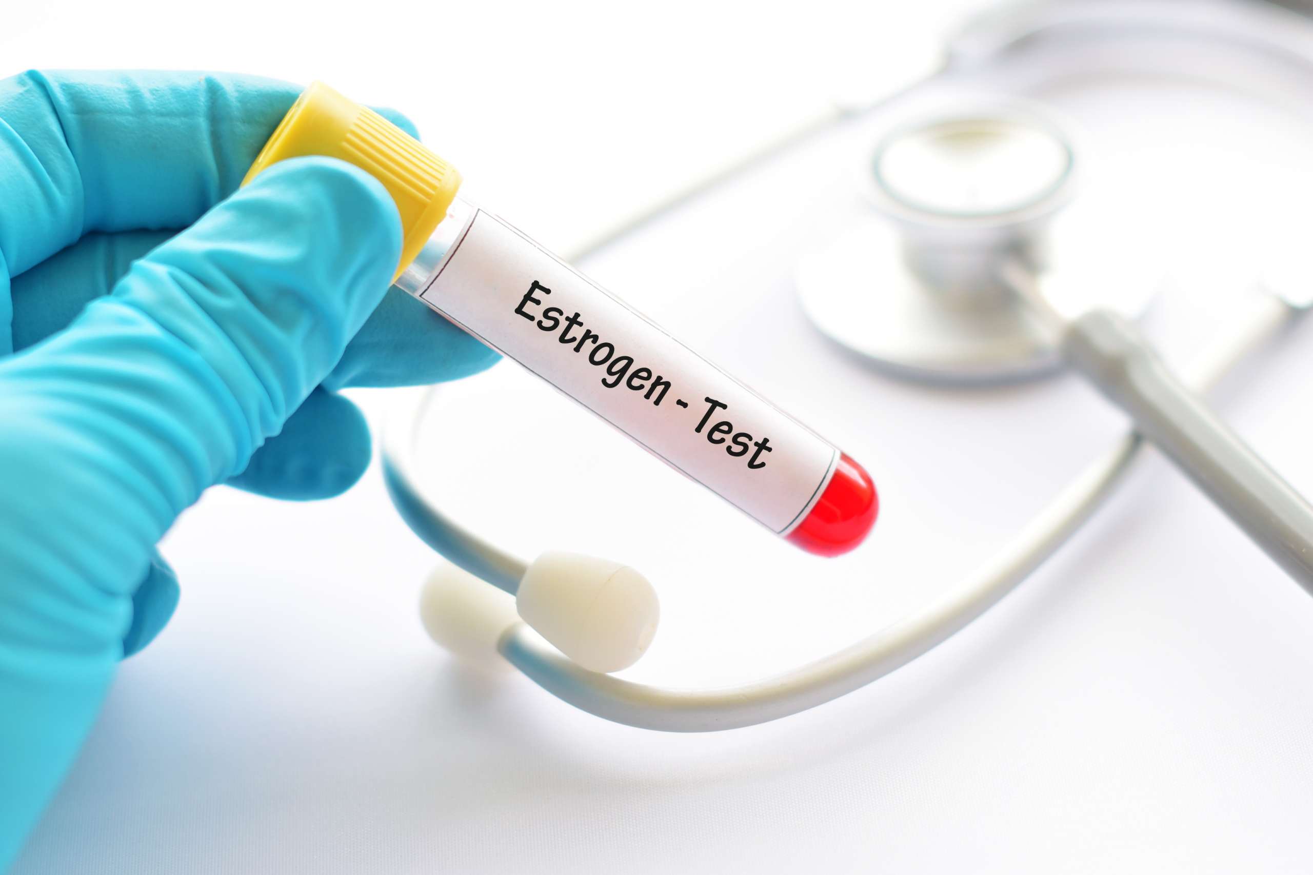 Estrogen hormone test- Polycystic Ovary Syndrome (PCOS)